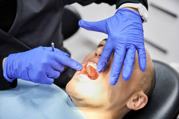 Best Emergency Dentist for Knocked-Out Tooth in Terre Hill, PA
